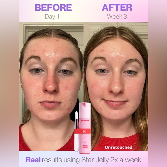 *NWT* kiramoon ⭐️ Star Jelly Mask, Magic Resurfacing Facial (10% AHA + Glycerin) - Picture 8 of 16